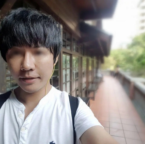 男性隆鼻+下巴手術案例,博恩妍